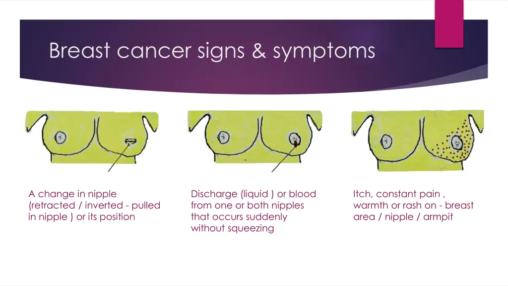 breast cancer signs symptoms 1