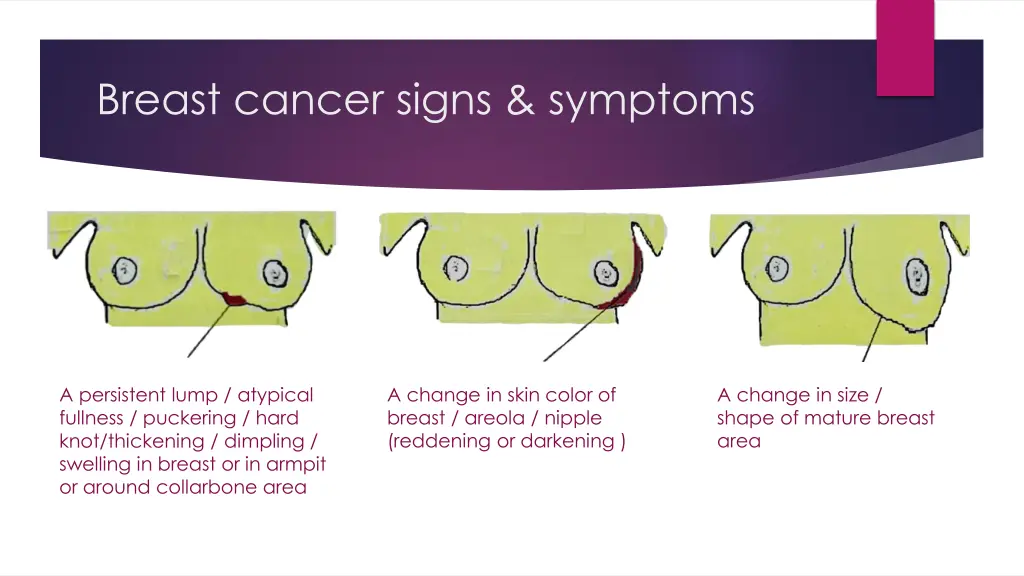 breast cancer signs symptoms