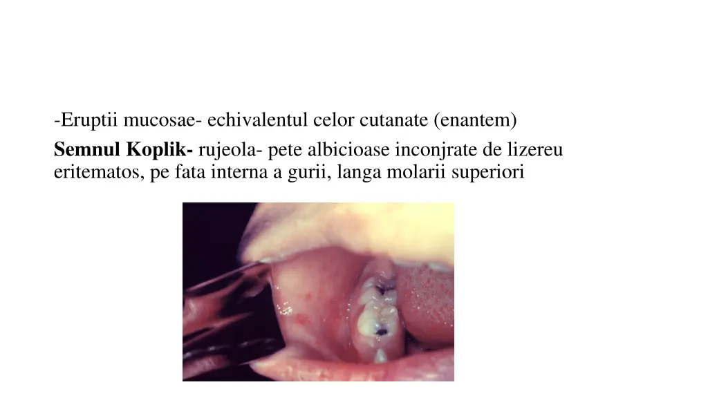 eruptii mucosae echivalentul celor cutanate