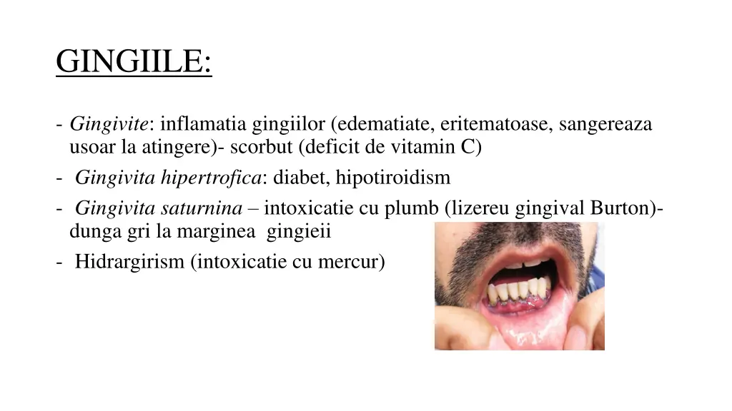 gingiile