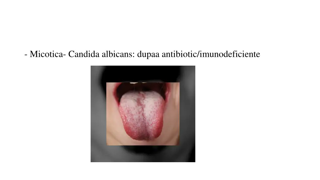 micotica candida albicans dupaa antibiotic