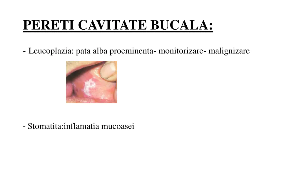 pereti cavitate bucala