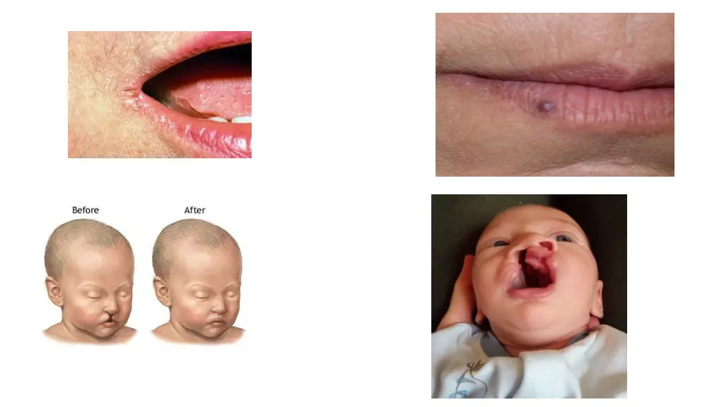 slide8