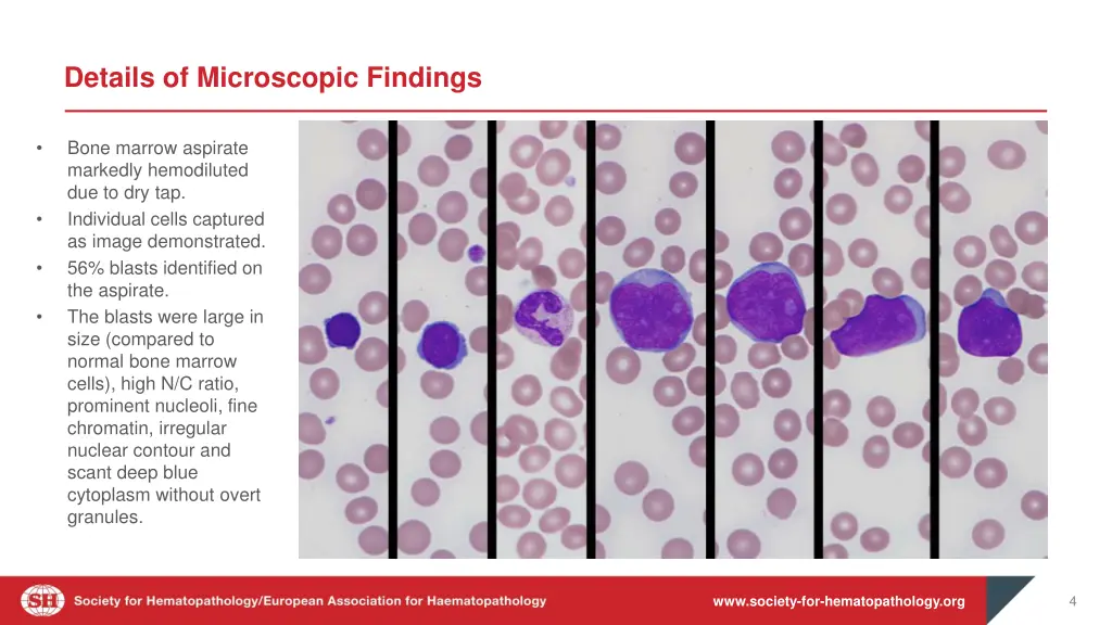 details of microscopic findings