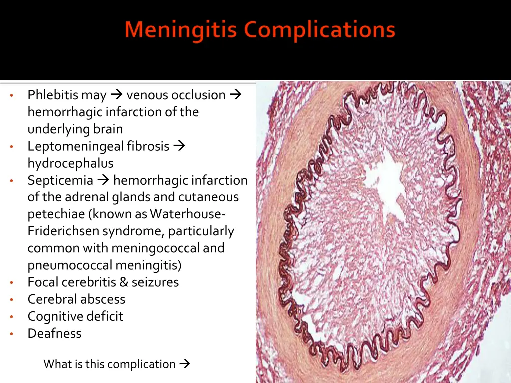 phlebitis may venous occlusion hemorrhagic