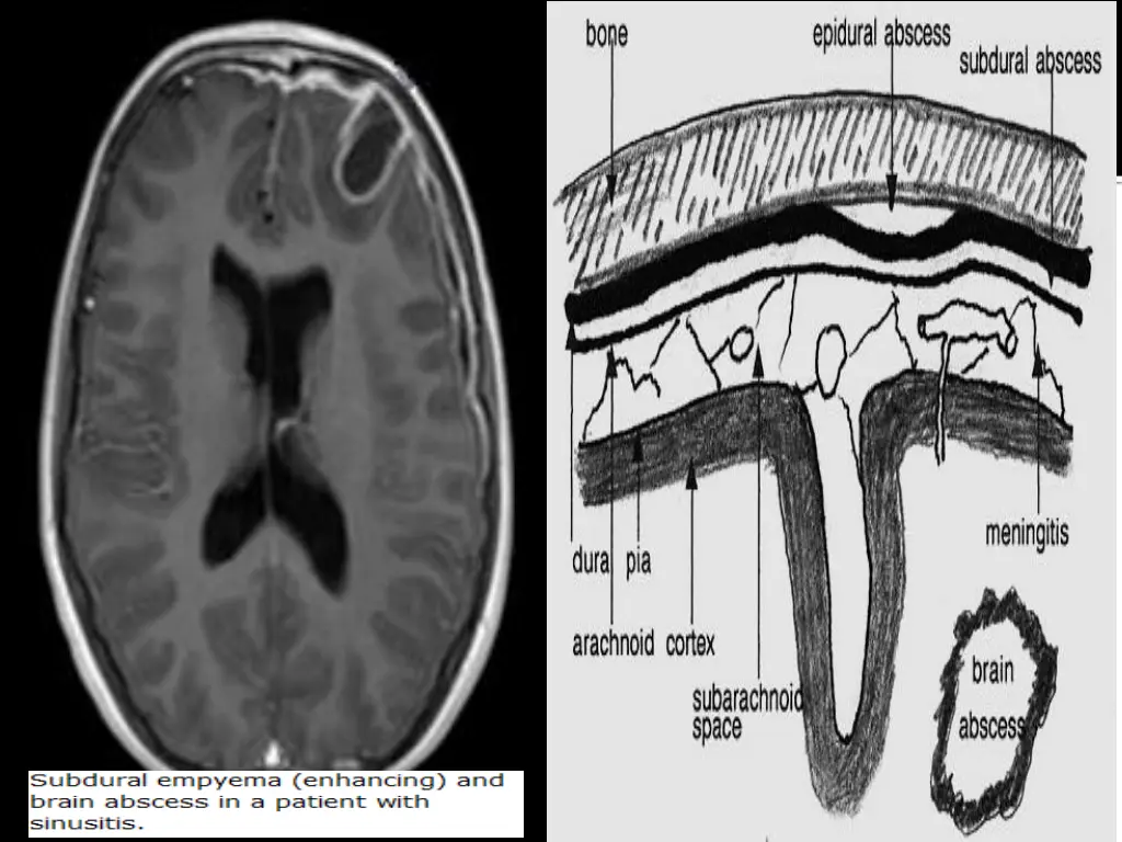 slide14