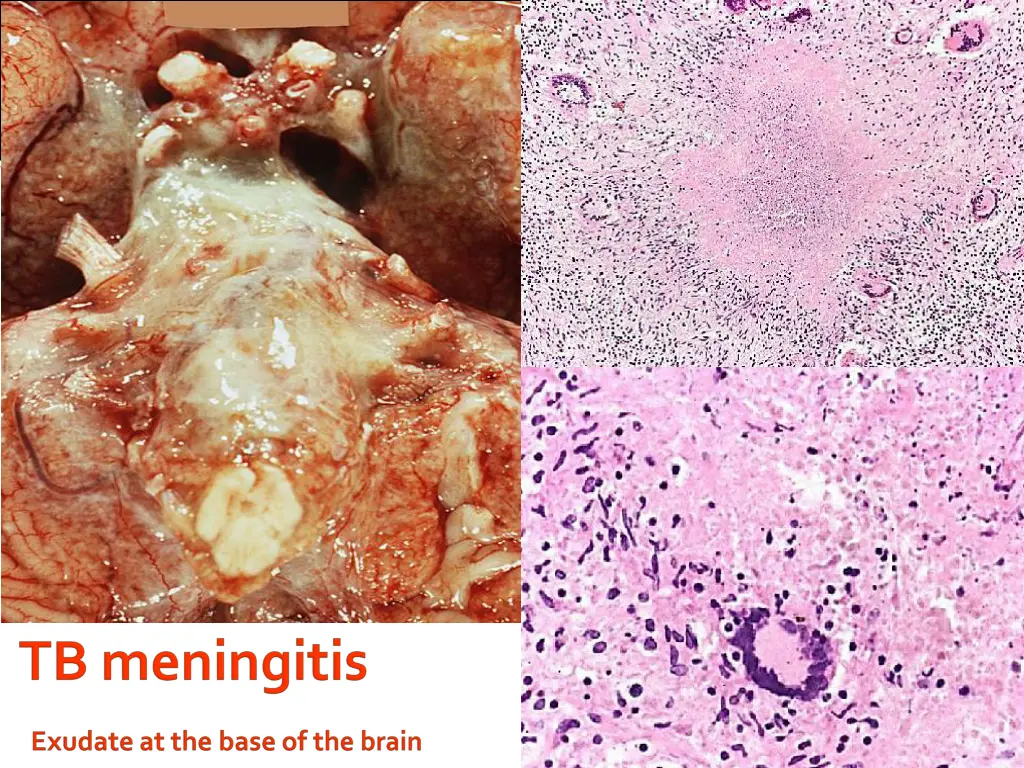 slide16