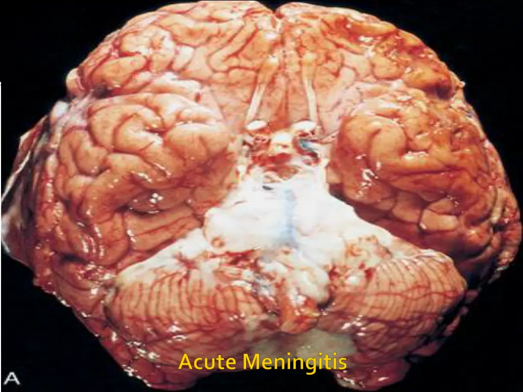 slide7