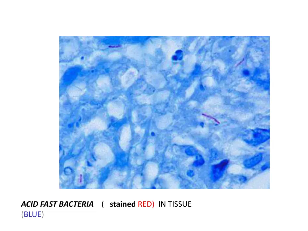 acid fast bacteria stained red in tissue blue