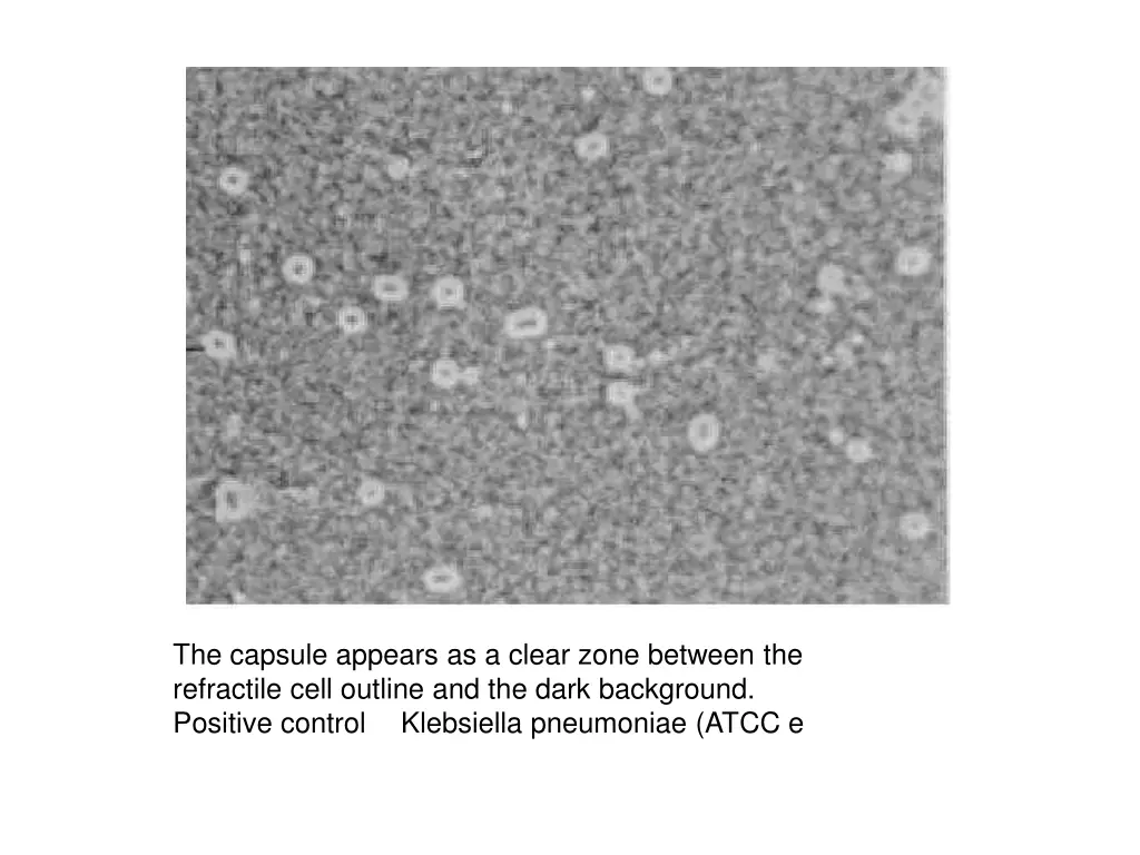 the capsule appears as a clear zone between