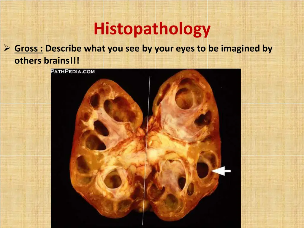 histopathology