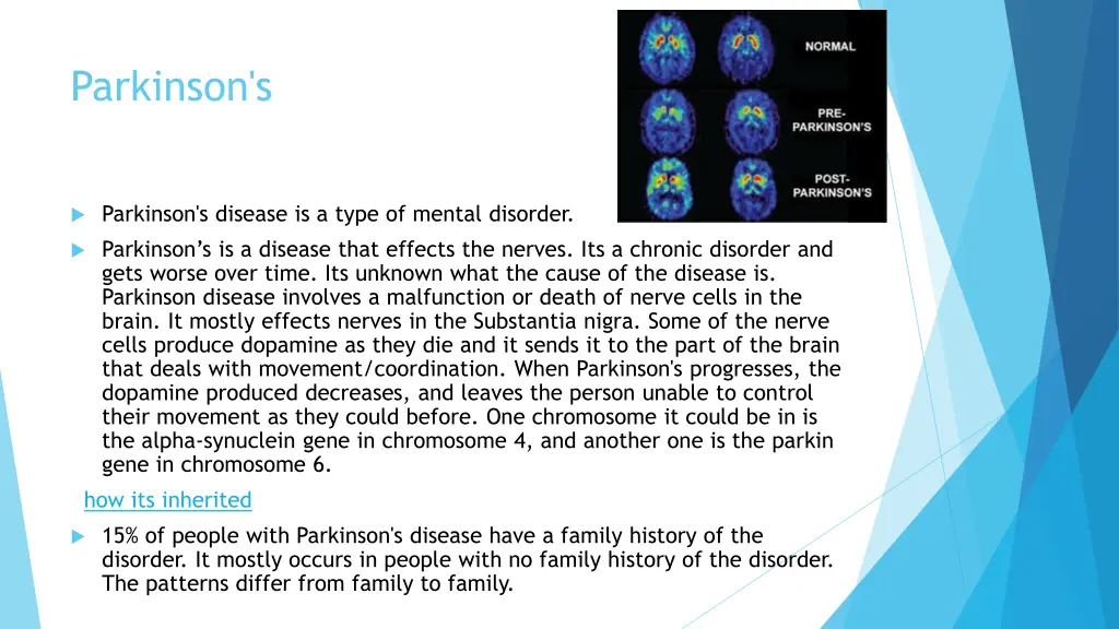 parkinson s