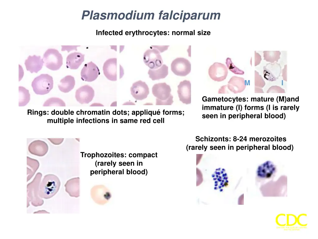 plasmodium falciparum