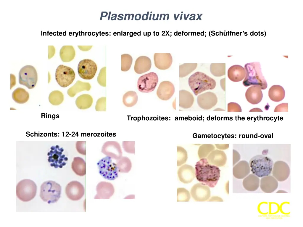 plasmodium vivax
