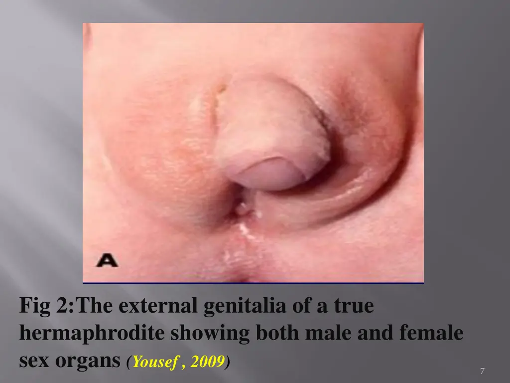 fig 2 the external genitalia of a true