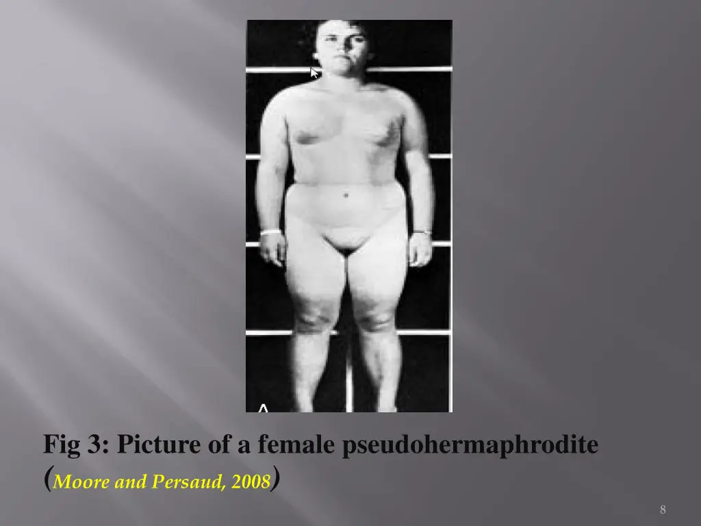 fig 3 picture of a female pseudohermaphrodite