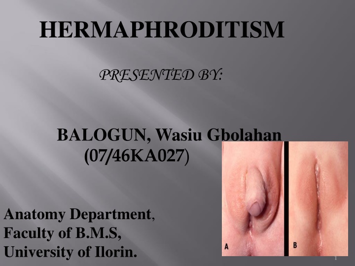 hermaphroditism