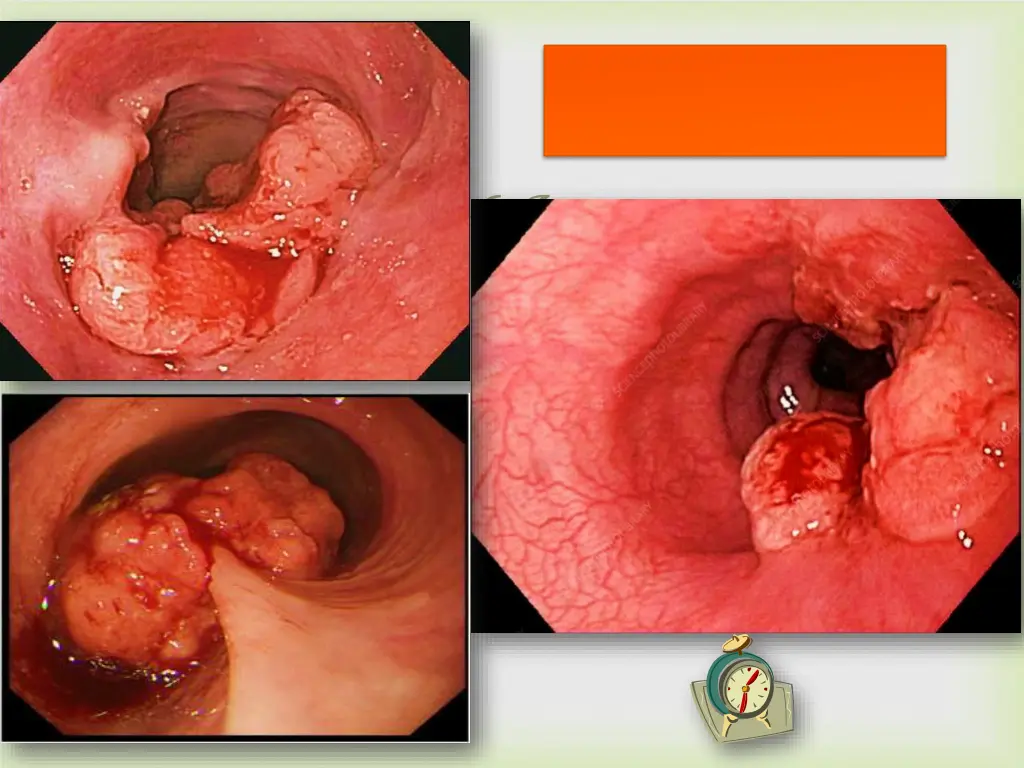 slide6