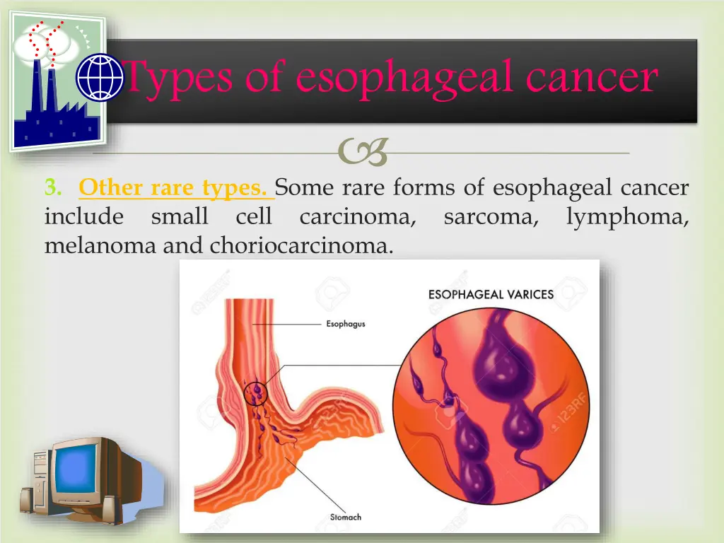 types of esophageal cancer 1
