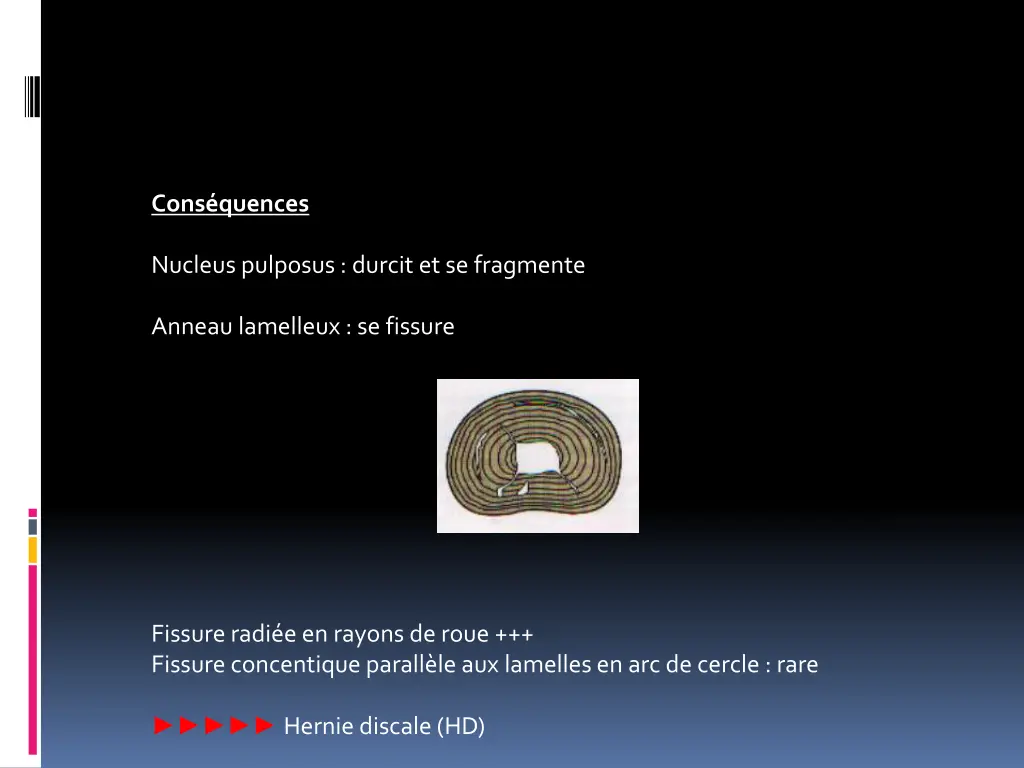 cons quences