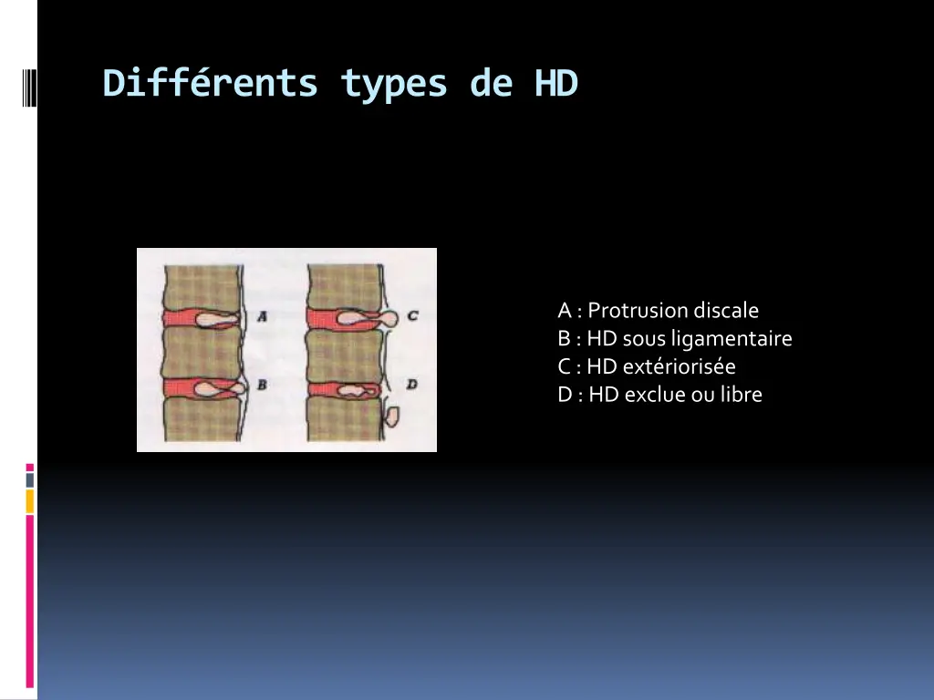 diff rents types de hd