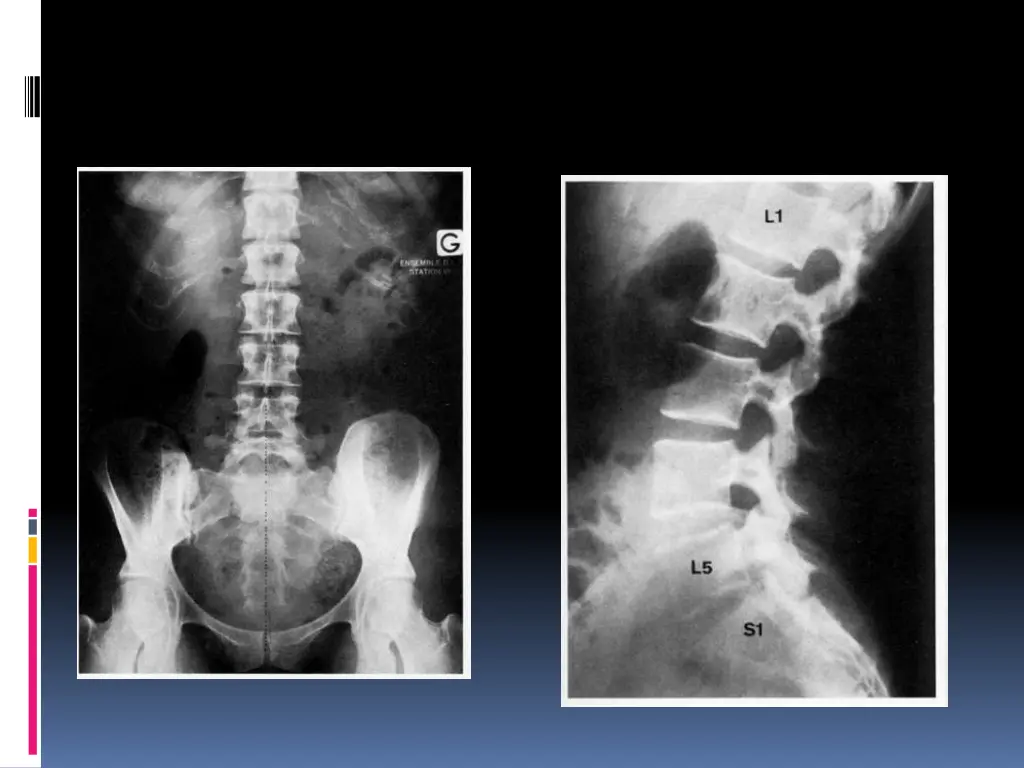 slide12