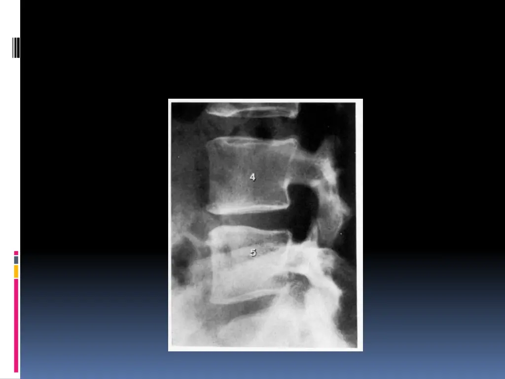 slide13
