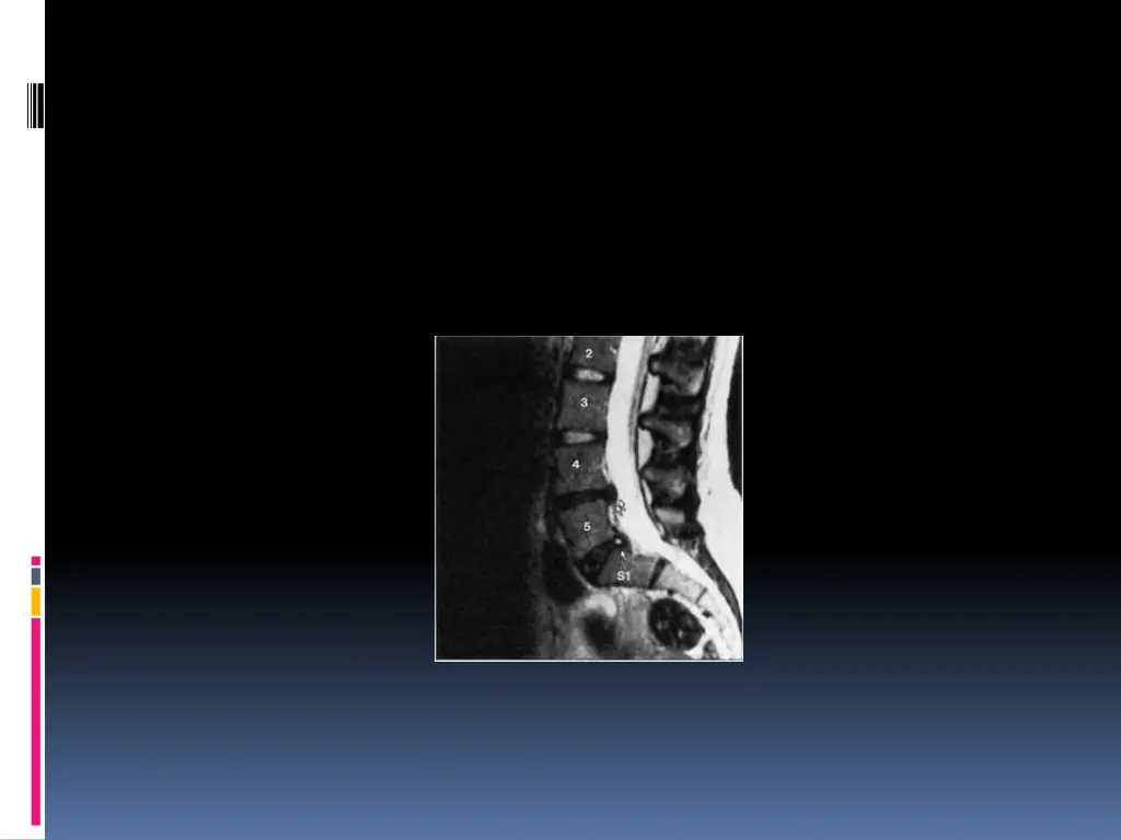 slide15