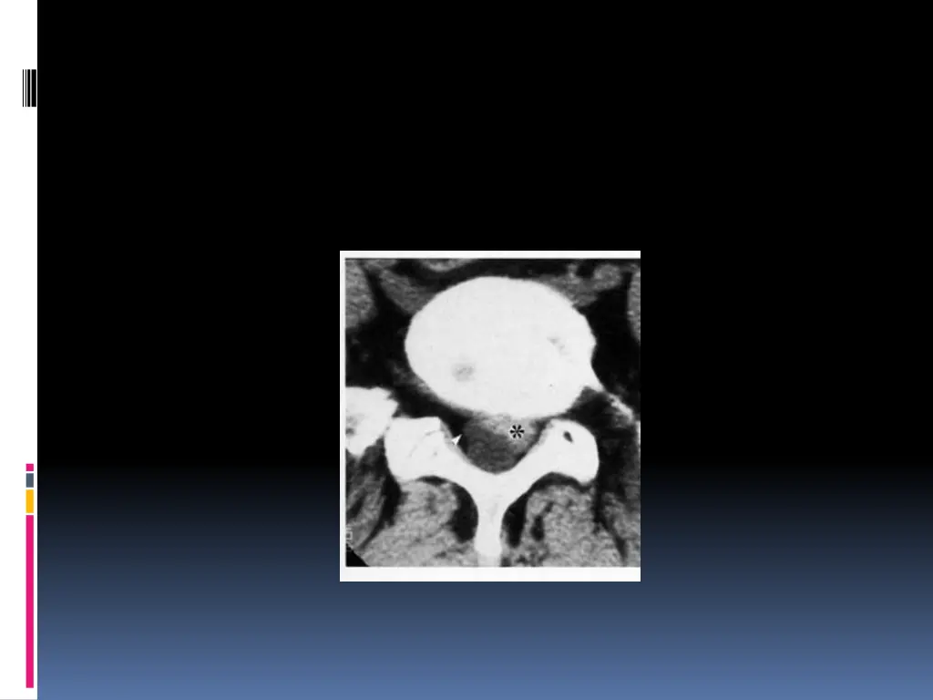 slide16