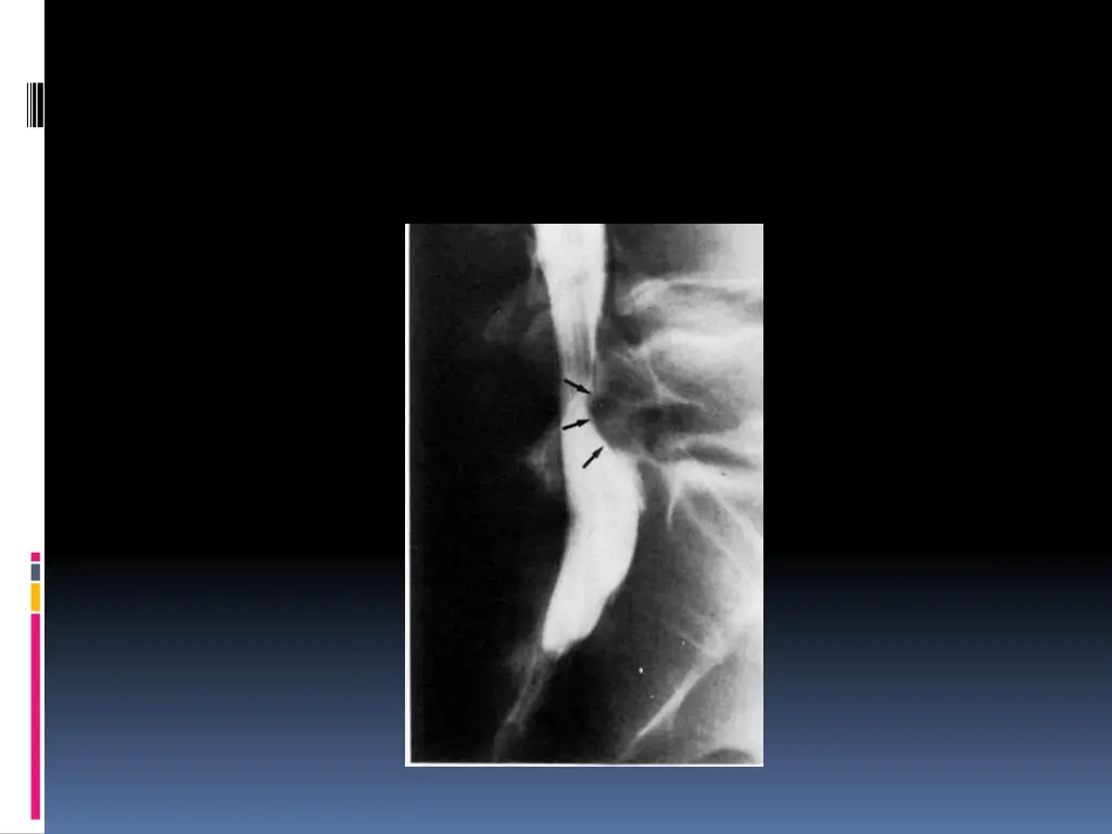 slide17