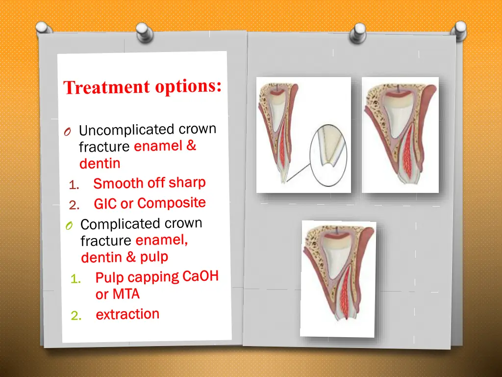 slide11