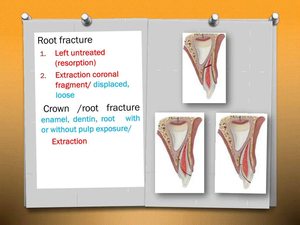 slide12
