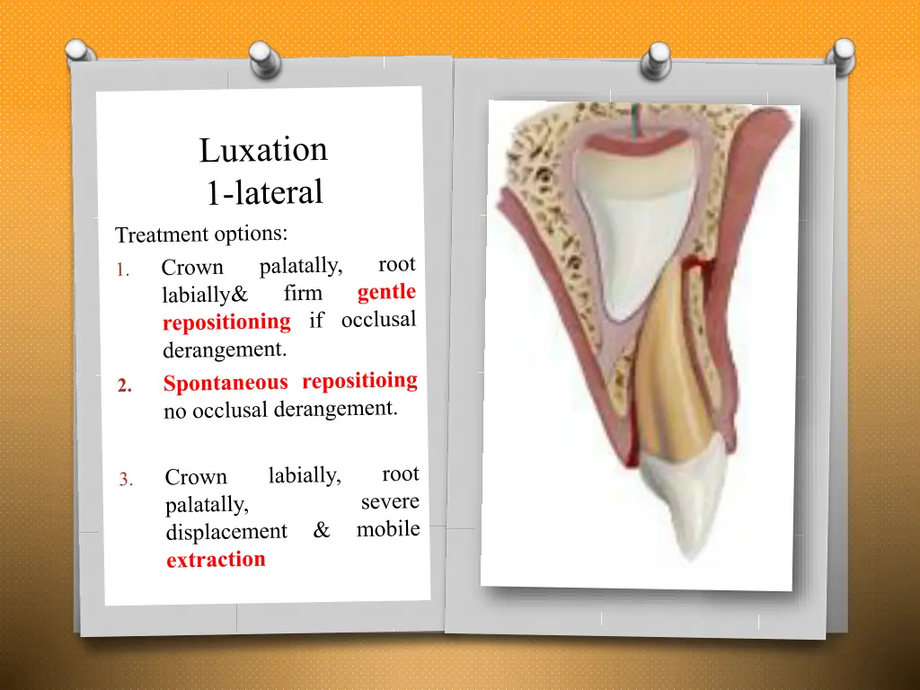 slide14