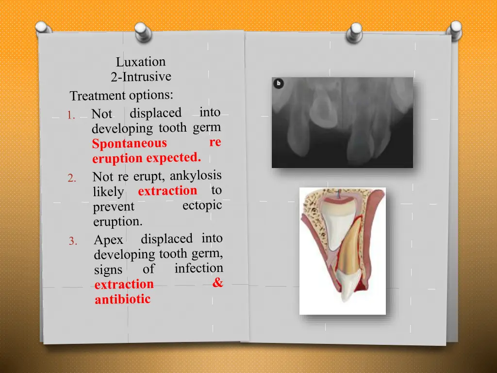 slide15