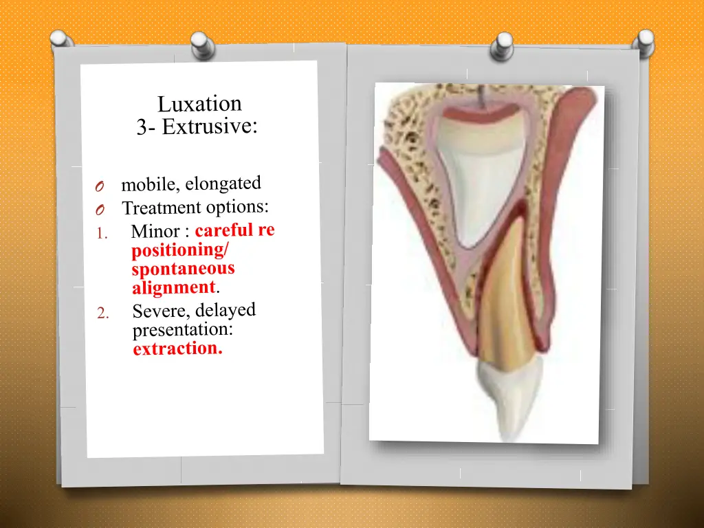 slide16