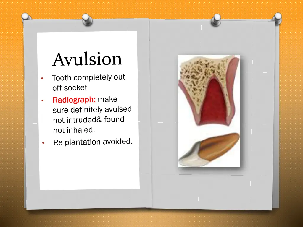 slide17
