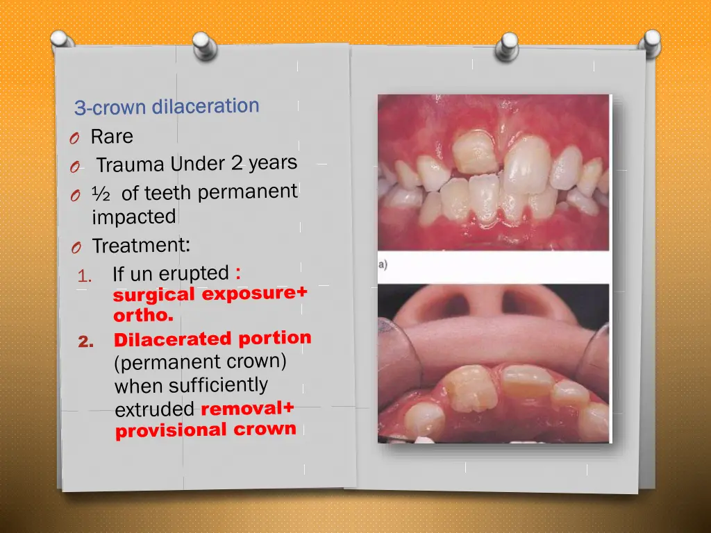 slide24