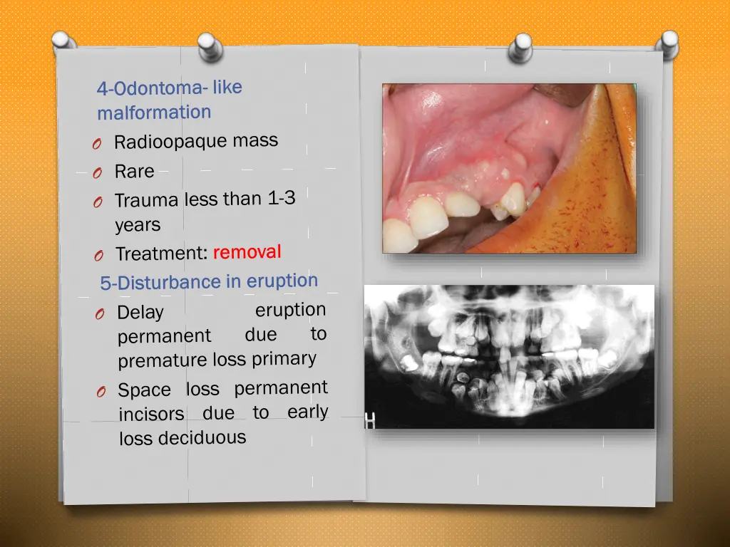 slide25