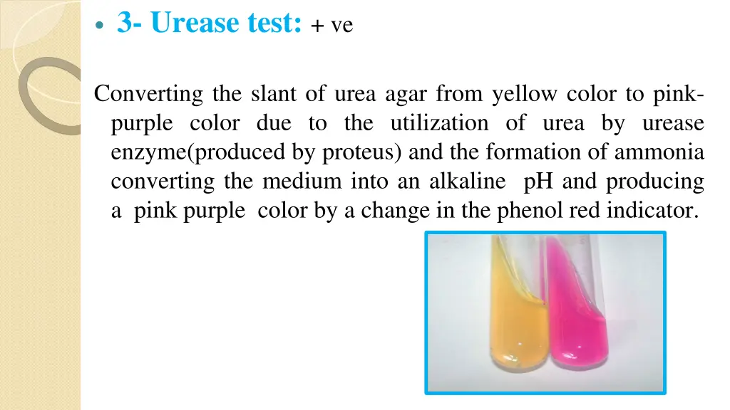 3 urease test ve