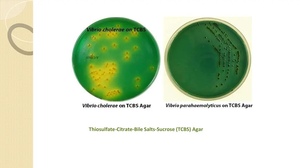 thiosulfate citrate bile salts sucrose tcbs agar
