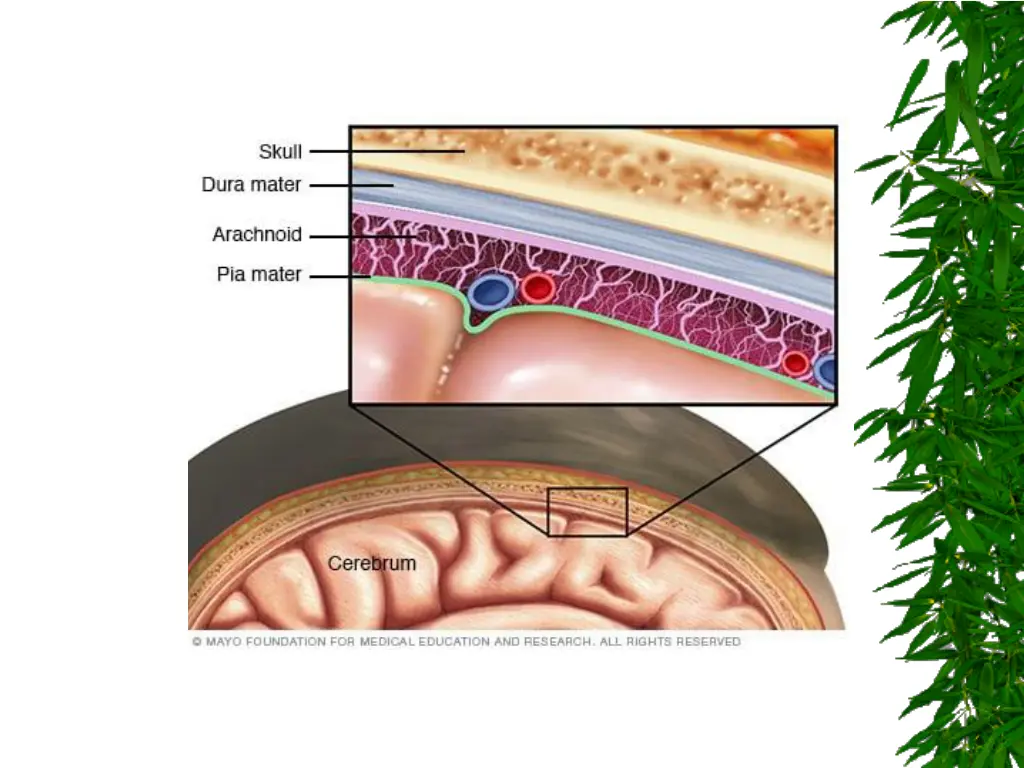 slide4