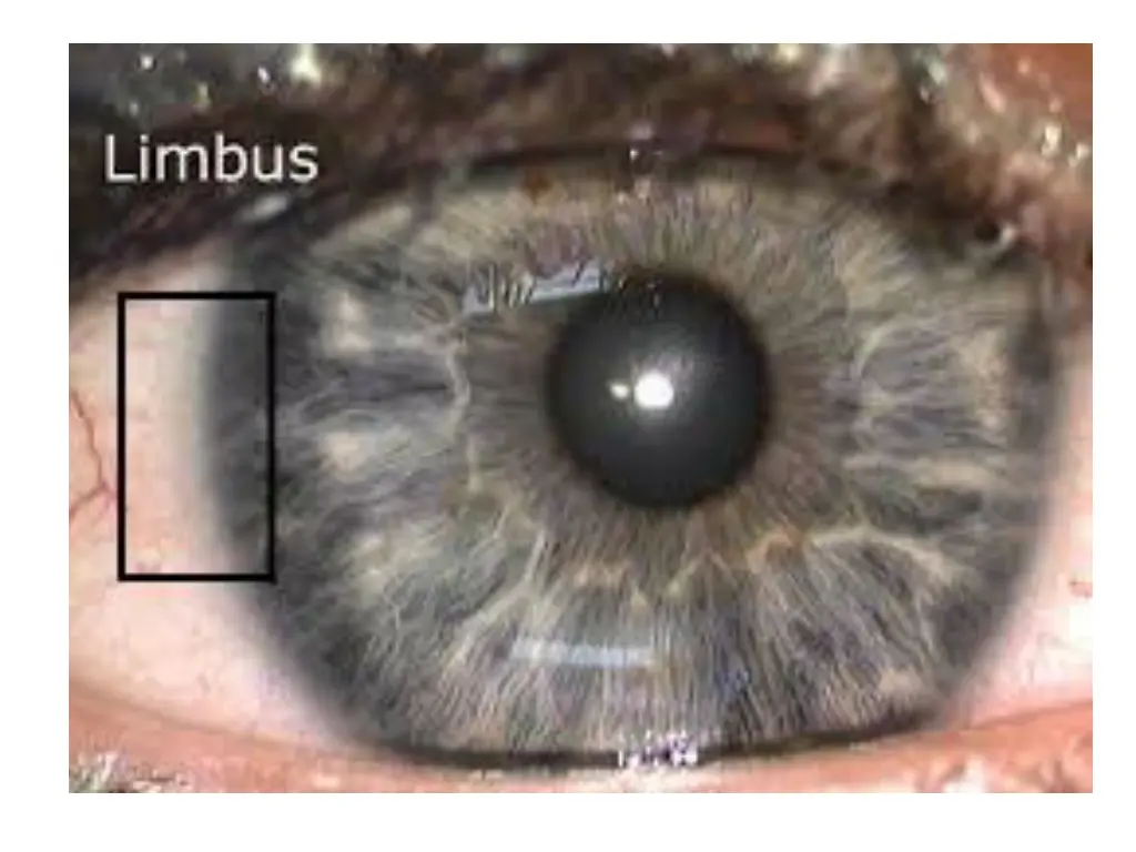 slide10