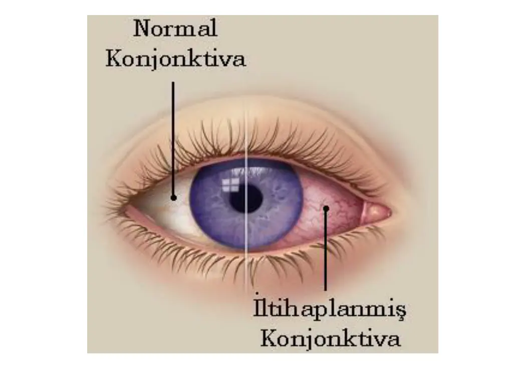 slide13