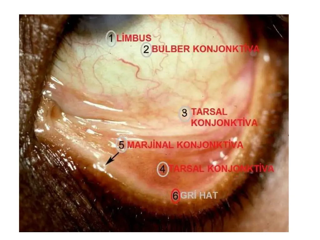 slide3