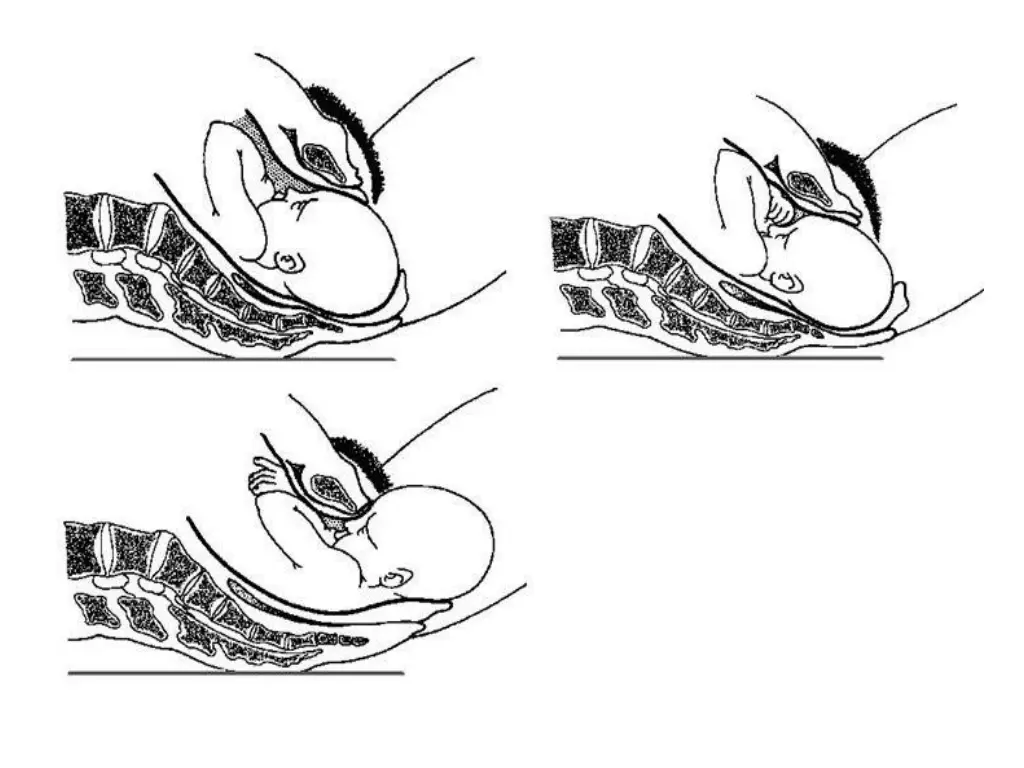 slide12