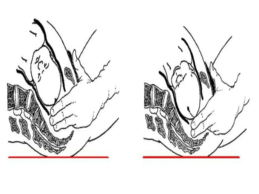 slide7