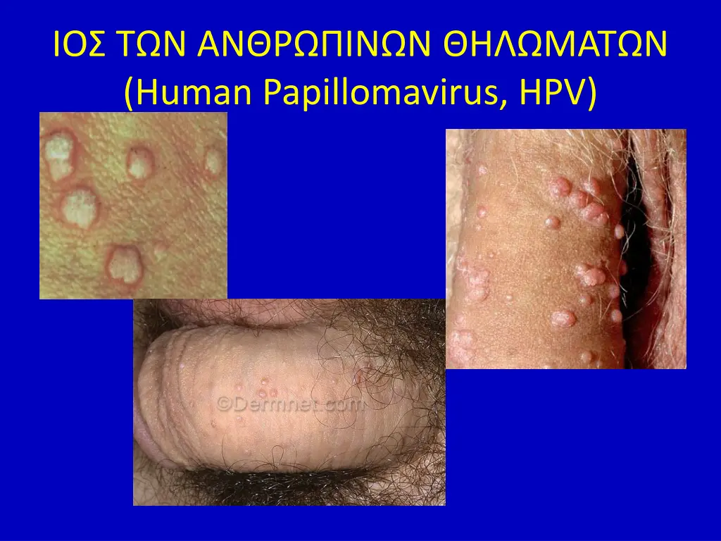 human papillomavirus hpv