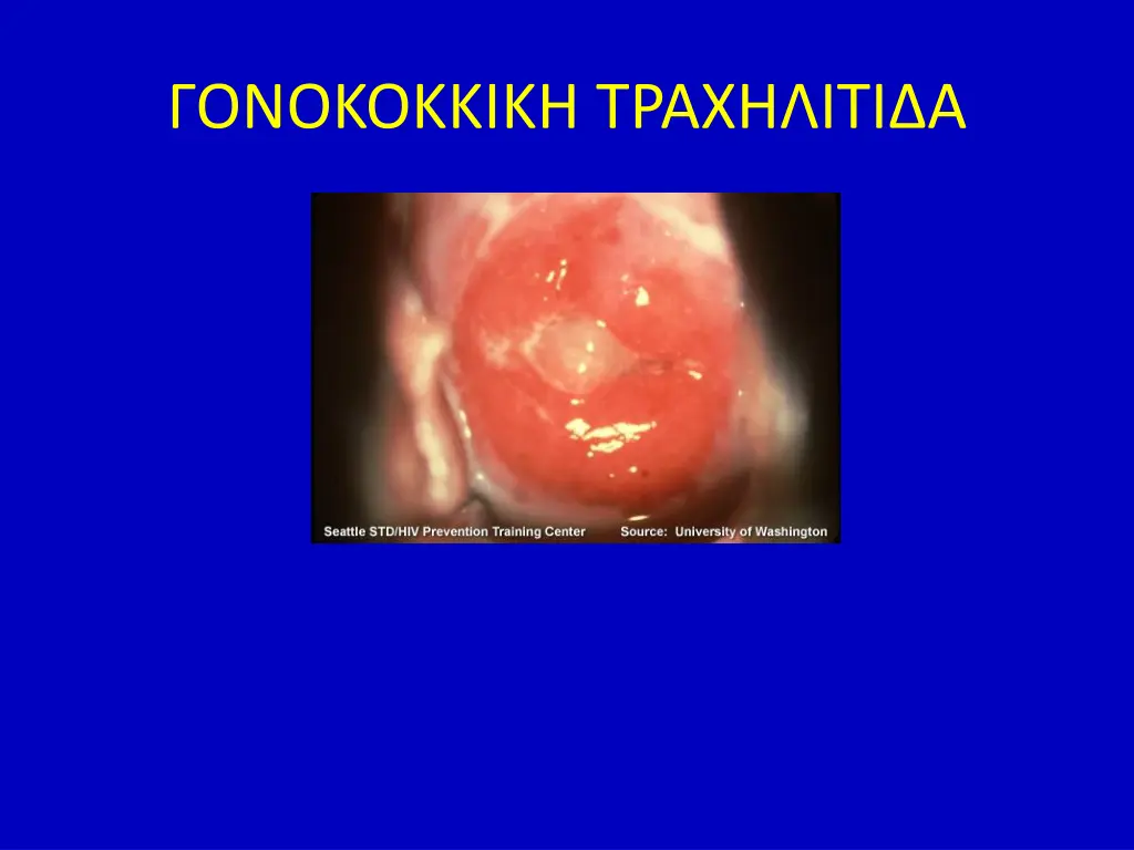 slide10