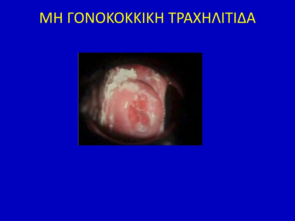 slide12