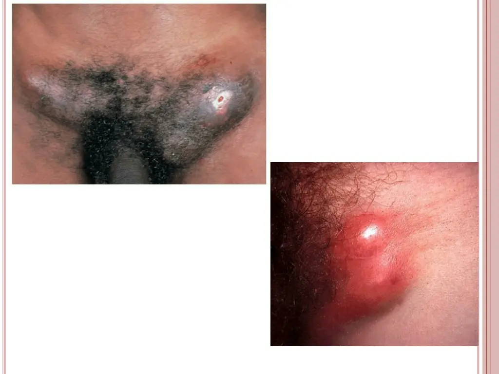 slide25